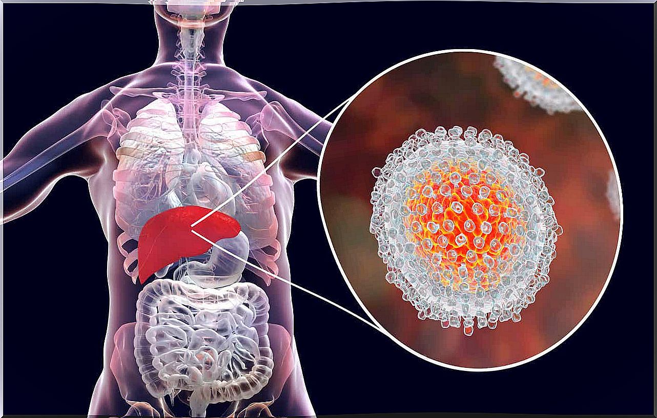 Hepatitis C During Pregnancy