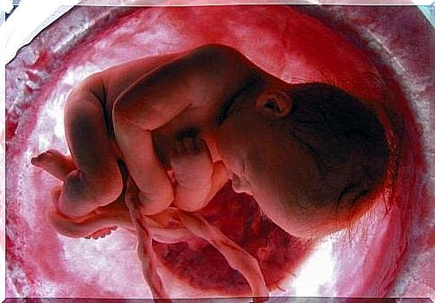 Placenta and umbilical cord