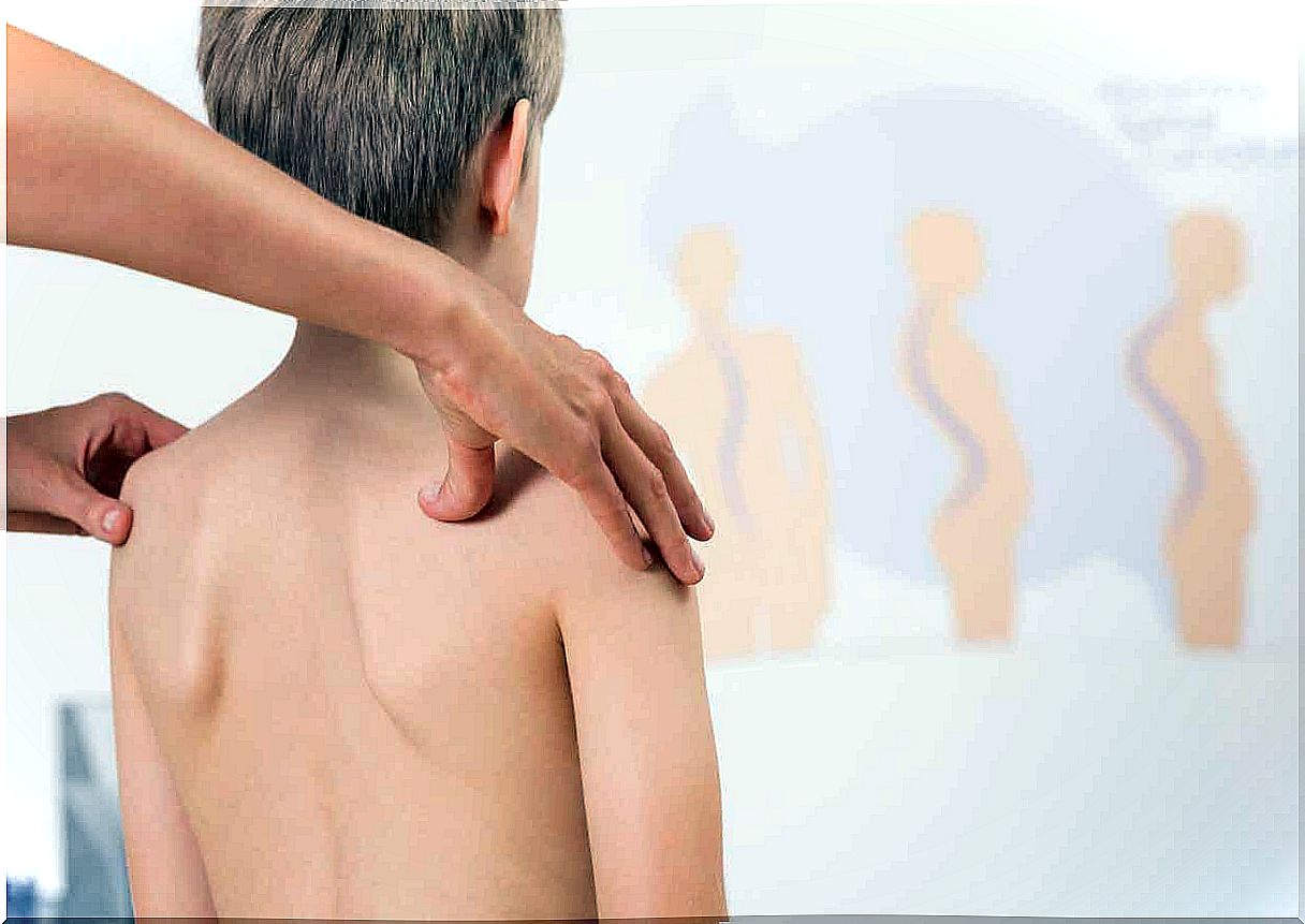 Scoliosis treatment.